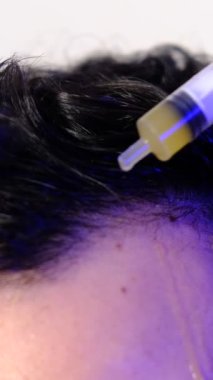 Saç bakımlı erkek imajı, saç dökülmesini önleyen bir kimyasal madde, saç bakımı için serum tedavisi.