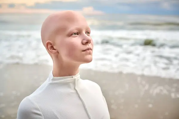 stock image Close up portrait of young hairless girl with alopecia in white futuristic costume on sea background, bald pretty teenage girl showcasing unique beauty and identity with pride, unusual alien girl