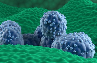 Prostat kanseri hücreleri protez beze epitelyumunda - yakın çekim görüntüsü 3d illüstrasyon