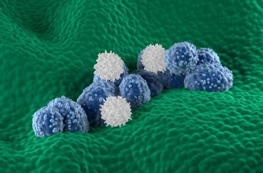 T-hücreleri prostat kanseri hücrelerine protez glandüler epitelyumla saldırır - izometrik görünüm 3d illüstrasyon