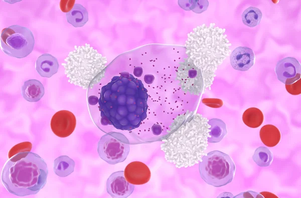 Células Atacam Célula Mieloma Múltiplo Fluxo Sanguíneo Visão Close Ilustração — Fotografia de Stock