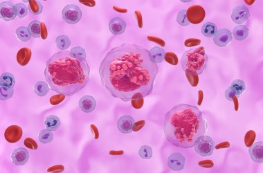 Kan akışındaki akut lenfoblastik lösemi (all) kanser hücreleri - izometrik görünüm 3d