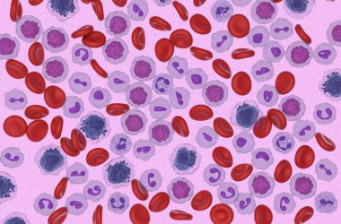 Kan akışındaki akut miyeloid lösemi (AML) hücreleri - mikroskobik görünüm 3d illüstrasyon