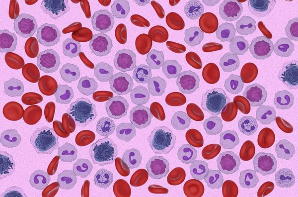Leucemia Mieloide Aguda Lma Células Fluxo Sanguíneo Visão Microscópica Ilustração — Fotografia de Stock