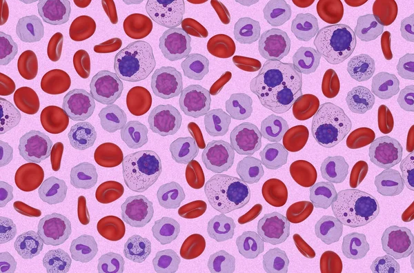 Szpiczak Mnogi Komórki Przepływie Krwi Widok Mikroskopowy Ilustracja — Zdjęcie stockowe