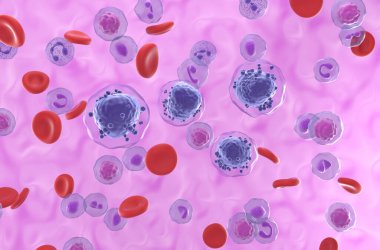 Kan akışında akut miyeloid lösemi (AML) hücreleri - izometrik görünüm 3d illüstrasyon