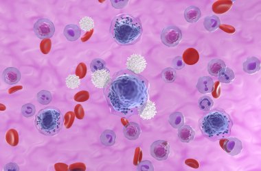 T-hücreleri kan akışındaki akut miyeloid lösemi (AML) hücrelerine saldırır - izometrik görünüm 3d