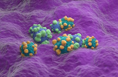 İnsan vücudundaki Adenokarsinom kanser hücreleri - izometrik görünüm 3d illüstrasyon