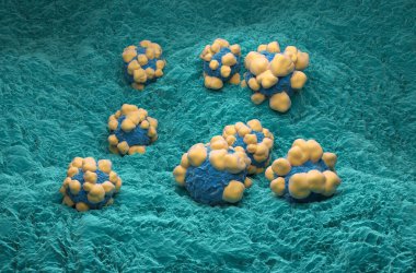 İnsan vücudundaki Adenokarsinom kanser hücreleri - izometrik görünüm 3d illüstrasyon