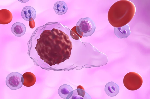 stock image Primary myelofibrosis (PMF) cells in blood flow - closeup view 3d illustration
