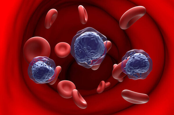 Acute myeloid leukemia (AML) cells in blood flow - section view 3d illustration
