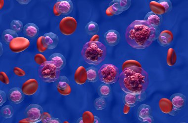 Kan akışındaki akut lenfoblastik lösemi (all) kanser hücreleri - izometrik görünüm 3d