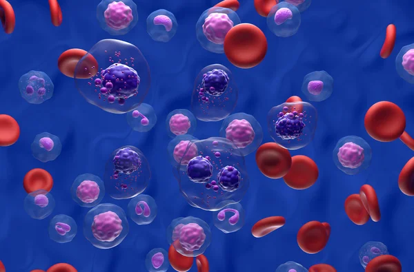 Mnohočetné Myelomové Buňky Shluk Průtoku Krve Izometrický Pohled Ilustrace — Stock fotografie