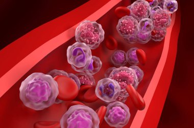 Kan akışındaki akut lenfoblastik lösemi (all) kanser hücreleri - yakın çekim görüntüsü 3d illüstrasyon