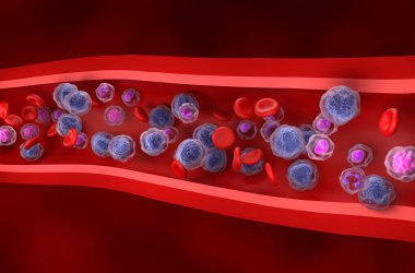 Kan akışında akut miyeloid lösemi (AML) hücreleri - izometrik görünüm 3d illüstrasyon
