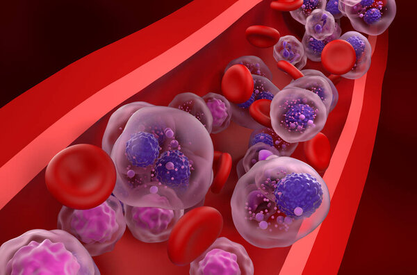Multiple myeloma (MM) cells in the blood flow - closeup view 3d illustration