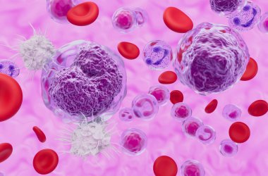 Dendritic cell recognize Non-hodgkin lymphoma (NHL) - closeup view 3d illustration