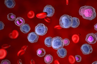 Akut miyeloid lösemi (AML) - izometrik görünüm 3d illüstrasyon
