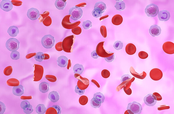 Клетки гемолитической анемии (HA) в кровотоке - изометрический вид 3d иллюстрация