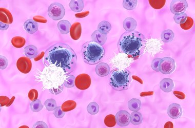 Dendritik hücreler (DC) akut miyeloid lösemiyi (AML) tanır - izometrik görünüm 3d illüstrasyon
