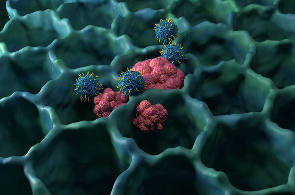 CAR Т-клеточная терапия при раке легких (LC) - изометрический вид трехмерной иллюстрации