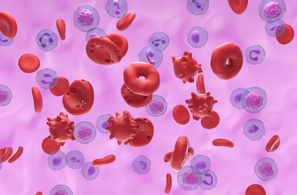 Hemolizisteki hasarlı kırmızı kan hücreleri - izometrik görünüm 3d illüstrasyon