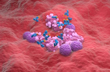 Yumurtalık kanserinde monoklonal antikor tedavisi - izometrik görünüm 3d illüstrasyon