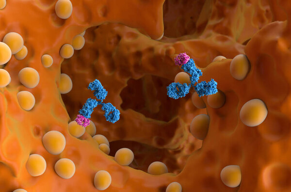 Лечение моноклональных антител в костной опухоли (рак) - вид крупным планом 3d иллюстрация