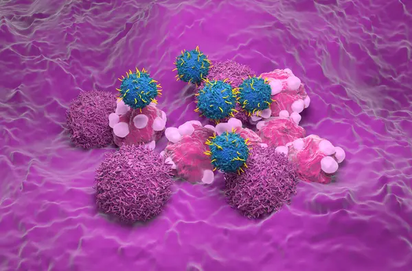 stock image CAR T cell therapy in Cervical cancer - isometric view 3d illustration