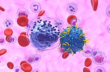Akut miyeloid lösemisinde (AML) CAR T hücre terapisi - 3d görünümü