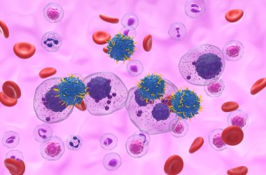 CAR T hücre terapisi Multiple myeloma (MM) - izometrik görünüm 3d illüstrasyon