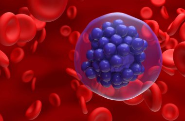 Geniş B hücreli lenfoma (DLBCL) - 3d görünümü kapat