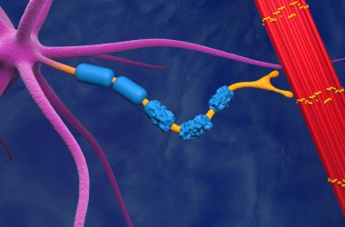 Motor nöron Amyotrofik Lateral Sclerosis (ALS) - 3d yakınlaştırma görüntüsü tarafından hasar gördü