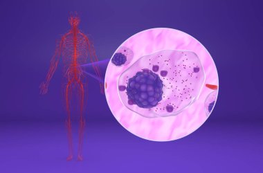 Kan akışında birden fazla miyelom (MM) hücresi - izometrik görünüm 3d illüstrasyon