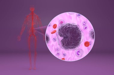 Non-hodgkin lenfoma (NHL) - izometrik görünüm 3d illüstrasyon