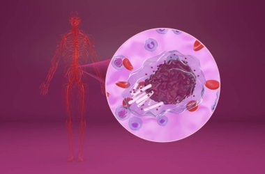 Kronik lenfositik lösemi (CLL) - izometrik görünüm 3d illüstrasyon