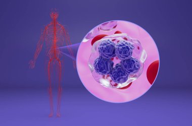 T-hücresi lenfoması - izometrik görünüm 3D illüstrasyon