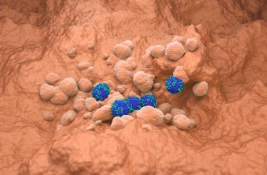 Akciğer dokusunda küçük hücreli akciğer kanseri (NSCLC) - izometrik görünüm 3d illüstrasyon