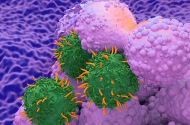 CAR T cell therapy in Breast cancer - closeup view 3d illustration clipart