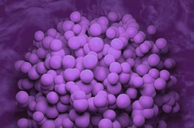 Glioblastoma multiforme - izometrik görünüm 3d illüstrasyon