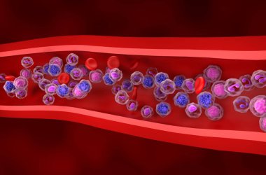 Geniş B hücreli lenfoma (DLBCL) - izometrik görünüm 3d illüstrasyon