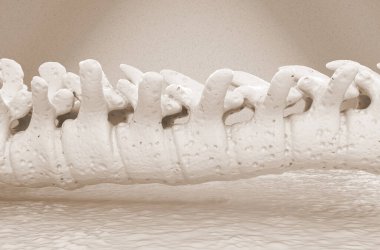Osteoporoz - omurga - yan görünüm 3d illüstrasyon