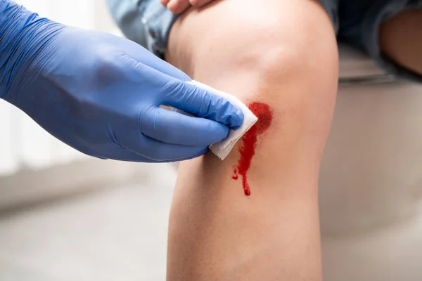 Nurse Helping Her Patient Perform First Aid Knee Injury She — Stock Photo, Image
