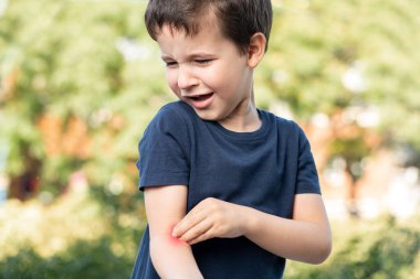 Child scratching arm because it stings in a park with a green background