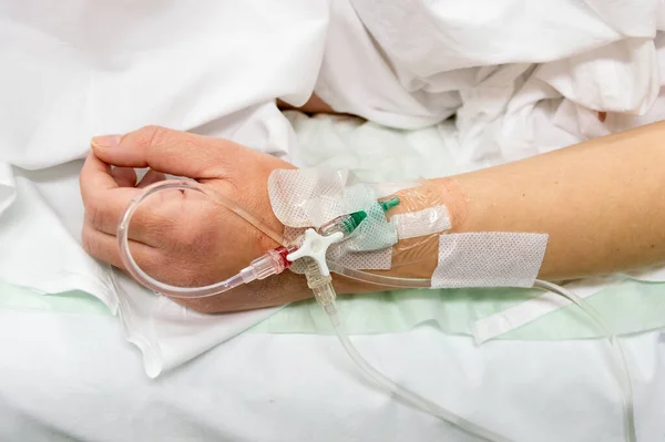 Ameliyathanede Kadın Kolunu Infüzyonla Kapat — Stok fotoğraf
