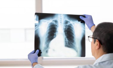 Genç bir doktorun klinikteki bir hastanın göğüs röntgenini analiz etmesi..