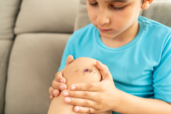 Close-up of young child boy bruised damaged injured knees after falling with old scars and fresh blood. Children traumas, accidents and treatment, problems of growing-up concept