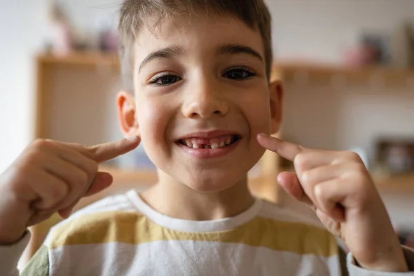 stock image one caucasian boy child at home with Deciduous primary milk teeth lost tooth fallen out dropped growing up concept copy space