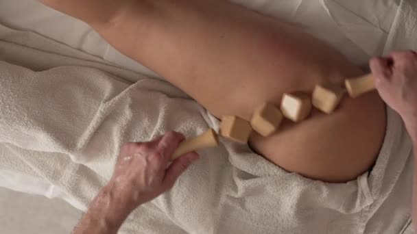 Onbekende Blanke Vrouw Met Maderotherapie Massage Cellulitis Behandeling Door Professionele — Stockvideo