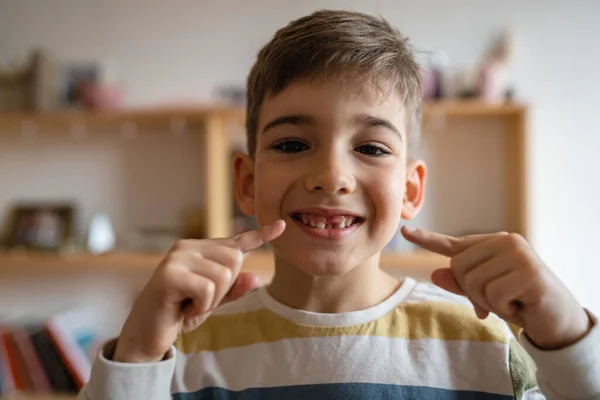 One Caucasian Boy Child Home Deciduous Primary Milk Teeth Lost — 스톡 사진